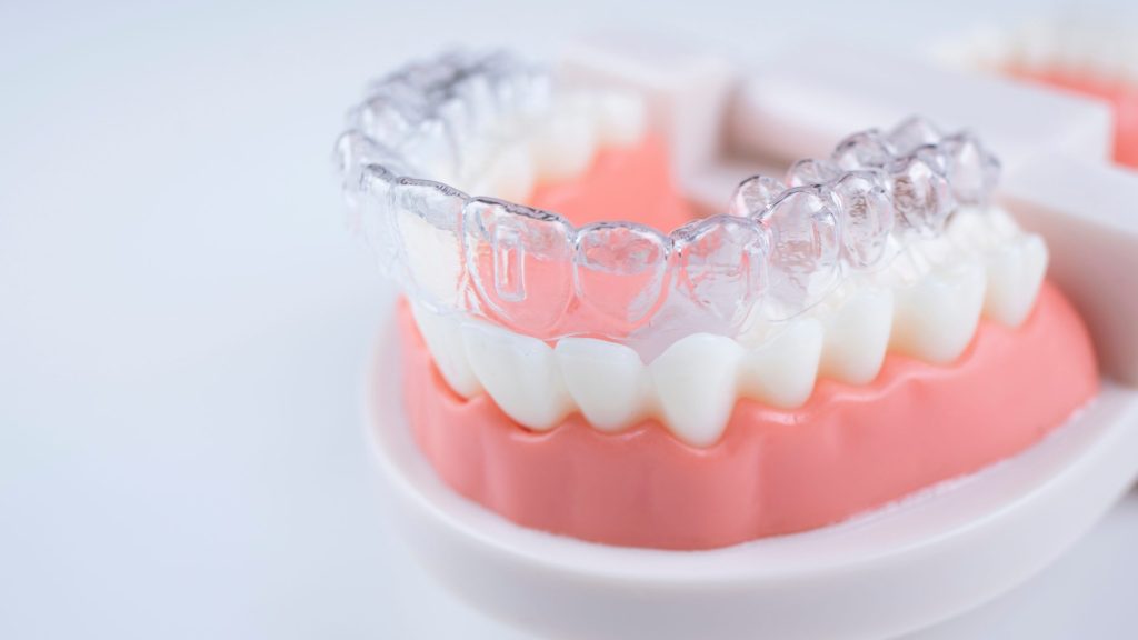 Clear Aligners vs Braces: The Best Fit For Busy Adult Schedules